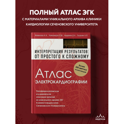 Атлас электрокардиографии. Интерпретация результатов: от простого к сложному