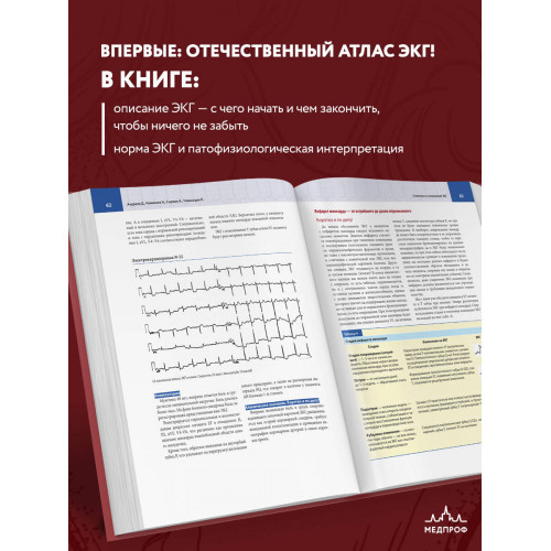 Атлас электрокардиографии. Интерпретация результатов: от простого к сложному