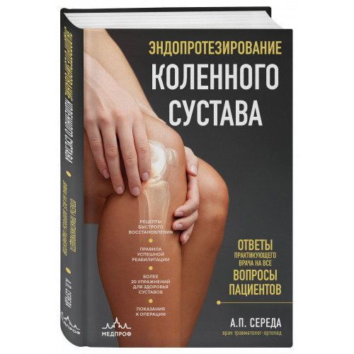 Эндопротезирование коленного сустава: ответы практикующего врача на все вопросы пациентов